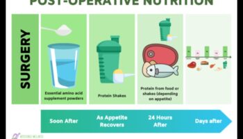 Olbaltumvielas un pēcoperācijas atveseļošanās: dziedināšanas uzlabošana